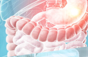 Adjustable gastric banding