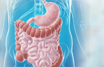 Sleeve gastrectomy