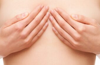 Areola correction