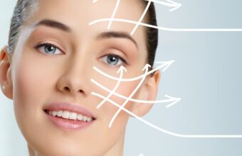 Face contour correction (facelift SMAS plane technique)