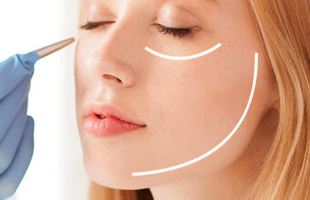 Plastic surgery of the face, neck, and décolleté area