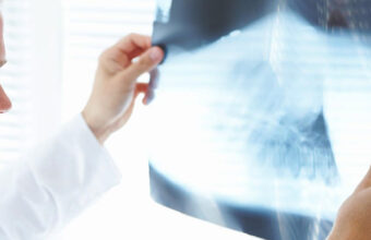 Crohn’s disease and nonspecific ulcerative colitis